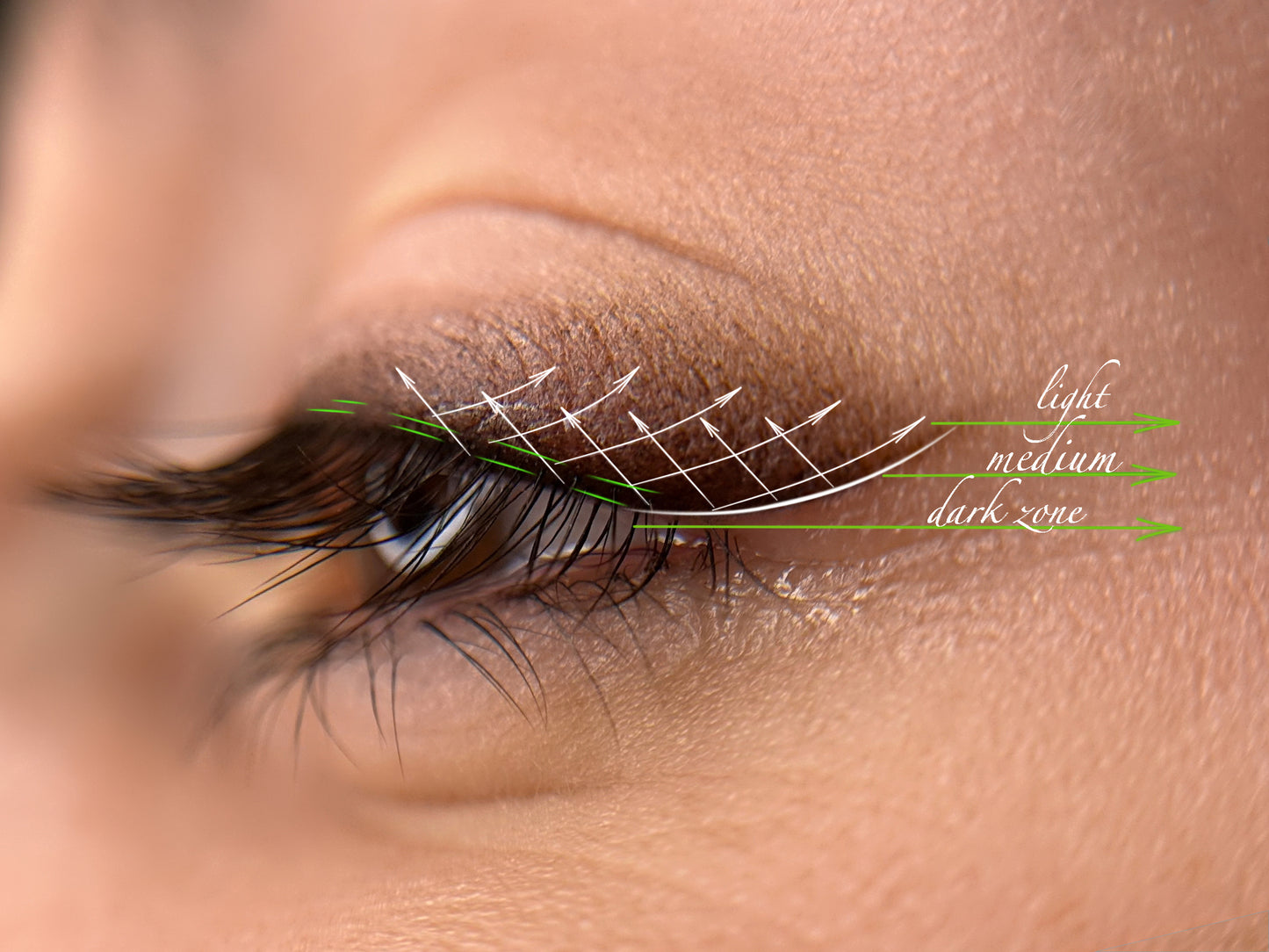 Velvet Liner Champion Technik